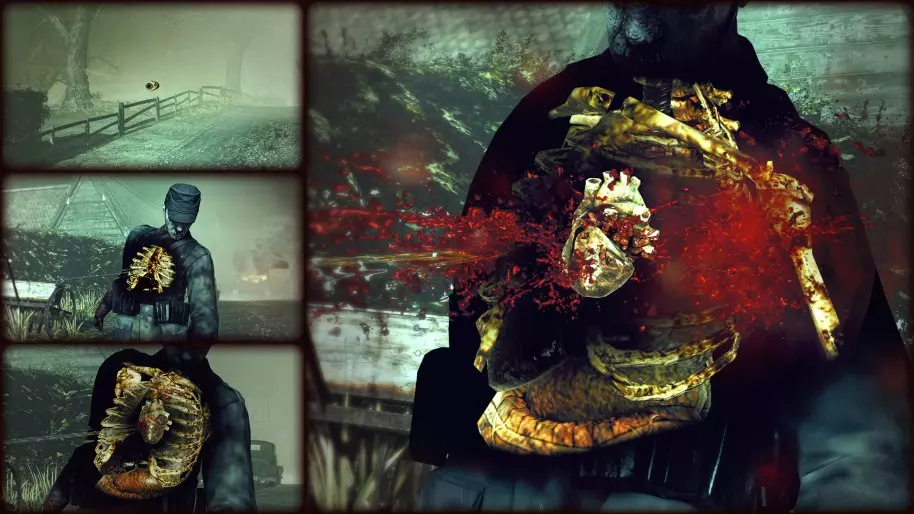 Zombie Army Trilogy Xbox One