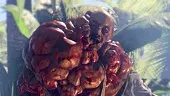 Dead Island Definitive Collection: Tráiler de Anuncio