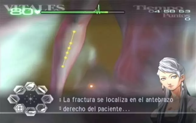 Trauma Center Second Opinion - Wii