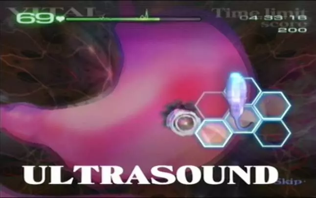 Trauma Center Second Opinion