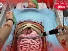 Surgeon Simulator CPR - Pantalla
